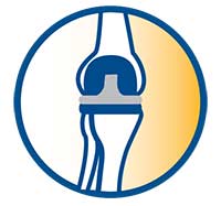 Icon of two bones with replaced joint