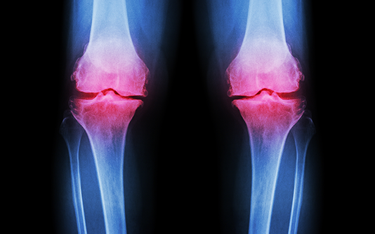 Exemple picture for Comprendre nos articulations